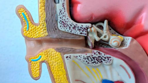 La sensación de taponamiento es uno de los principales síntomas del tímpano retraído