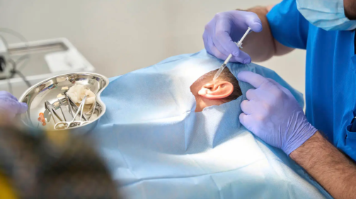 La operación de otosclerosis sustituye el estribo por una prótesis