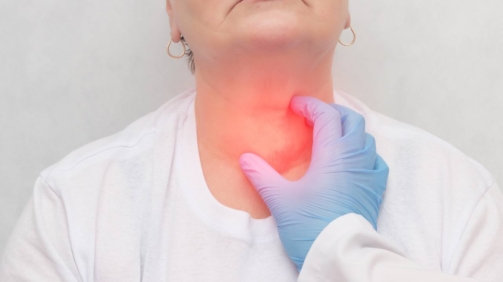 hipotiroidismo en la menopausia