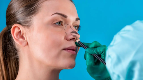 El precio de una rinoplastia segura debe reflejar la experiencia y cualificación del cirujano