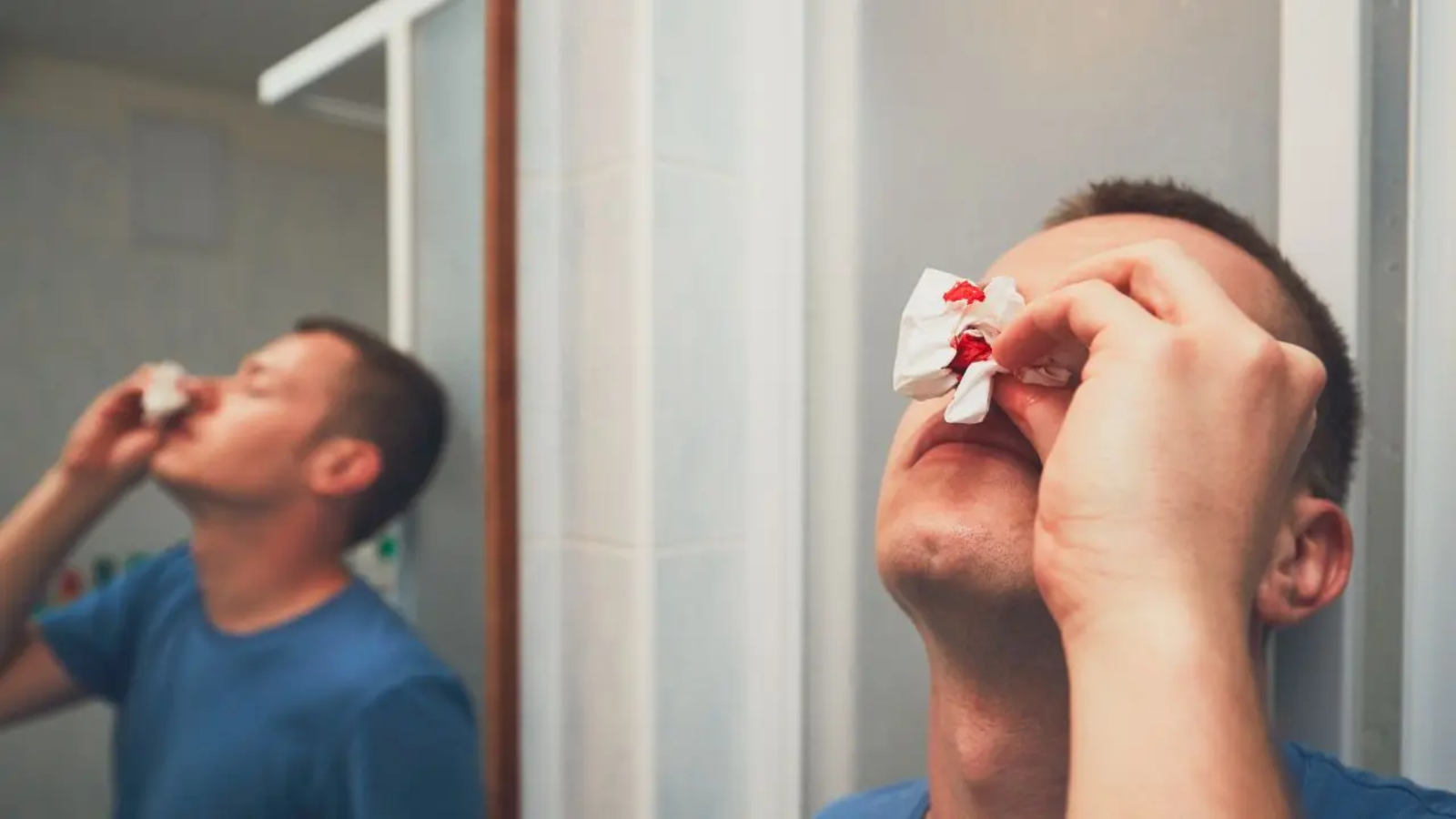 En la mayoría de las personas, la hemorragia nasal crónica se debe a causas locales